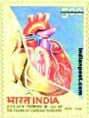 100 YEARS OF CARDIAC SURGERY 1653 Indian Post